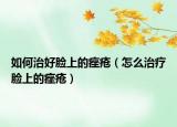 如何治好脸上的痤疮（怎么治疗脸上的痤疮）