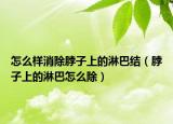 怎么样消除脖子上的淋巴结（脖子上的淋巴怎么除）