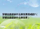 牙龈出血是缺什么维生素造成的?（牙龈出血是缺什么维生素）