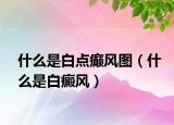 什么是白点癫风图（什么是白癜风）