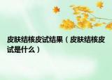 皮肤结核皮试结果（皮肤结核皮试是什么）