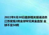 2022年8月30日最新相关报道消息 江苏发现2例全球罕见黄金血型 全球不足50例