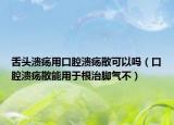 舌头溃疡用口腔溃疡散可以吗（口腔溃疡散能用于根治脚气不）