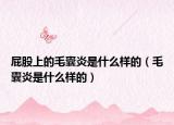 屁股上的毛囊炎是什么样的（毛囊炎是什么样的）
