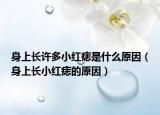 身上长许多小红痣是什么原因（身上长小红痣的原因）