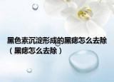 黑色素沉淀形成的黑痣怎么去除（黑痣怎么去除）