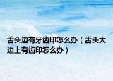 舌头边有牙齿印怎么办（舌头大边上有齿印怎么办）