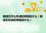 胆结石怎么形成的原因是什么（胆结石形成的原因是什么）
