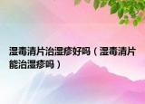 湿毒清片治湿疹好吗（湿毒清片能治湿疹吗）