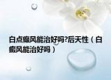 白点癫风能治好吗?后天性（白癜风能治好吗）