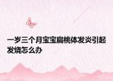 一岁三个月宝宝扁桃体发炎引起发烧怎么办