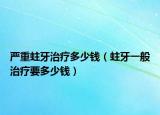 严重蛀牙治疗多少钱（蛀牙一般治疗要多少钱）