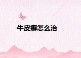 牛皮癣怎么治