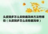 头皮屑多怎么去除最简单方法有哪些（头皮屑多怎么去除最简单）