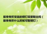 髌骨骨折里面的钢钉需要取出吗（髌骨骨折什么时候可取钢钉）
