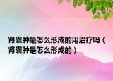 肾囊肿是怎么形成的用治疗吗（肾囊肿是怎么形成的）