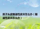 孩子头皮脂溢性皮炎怎么办（脂溢性皮炎怎么办）