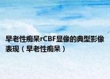 早老性痴呆rCBF显像的典型影像表现（早老性痴呆）