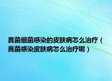 真菌细菌感染的皮肤病怎么治疗（真菌感染皮肤病怎么治疗呢）