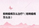 粉刺痤疮怎么治疗?（粉刺痤疮怎么治）