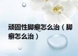顽固性脚癣怎么治（脚癣怎么治）