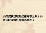 小孩皮肤过敏起红疙瘩怎么办（小孩皮肤过敏红疙瘩怎么办）