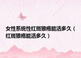 女性系统性红斑狼疮能活多久（红斑狼疮能活多久）
