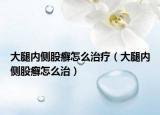 大腿内侧股癣怎么治疗（大腿内侧股癣怎么治）