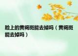 脸上的黄褐斑能去掉吗（黄褐斑能去掉吗）