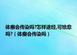体癣会传染吗?怎样途经,可给愈吗?（体癣会传染吗）