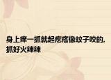 身上痒一抓就起疙瘩像蚊子咬的,抓好火辣辣