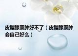 皮脂腺囊肿好不了（皮脂腺囊肿会自己好么）