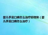 婴儿手足口病怎么治疗好得快（婴儿手足口病怎么治疗）