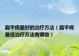 扁平疣最好的治疗方法（扁平疣最佳治疗方法有哪些）