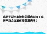 嘴唇干裂出血接触艾滋病血液（嘴唇干裂会血液传播艾滋病吗）