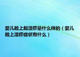 婴儿脸上起湿疹是什么样的（婴儿脸上湿疹症状有什么）