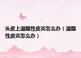 头皮上溢脂性皮炎怎么办（溢脂性皮炎怎么办）