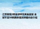 江苏发现2例全球罕见黄金血型 全球不足50例具体情况详细内容介绍