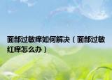面部过敏痒如何解决（面部过敏红痒怎么办）