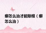 癣怎么治才能除根（癣怎么治）