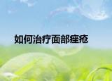 如何治疗面部痤疮