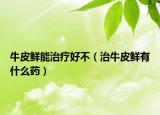 牛皮鲜能治疗好不（治牛皮鲜有什么药）