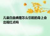 儿童白血病是怎么引起的身上会出现红点吗
