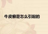 牛皮癣是怎么引起的