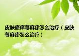 皮肤瘙痒荨麻疹怎么治疗（皮肤荨麻疹怎么治疗）