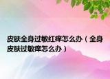 皮肤全身过敏红痒怎么办（全身皮肤过敏痒怎么办）