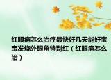红眼病怎么治疗最快好几天能好宝宝发烧外眼角特别红（红眼病怎么治）