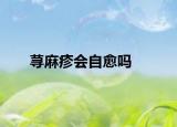 荨麻疹会自愈吗