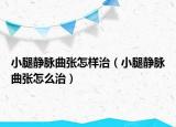 小腿静脉曲张怎样治（小腿静脉曲张怎么治）
