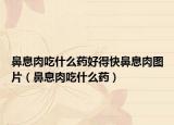 鼻息肉吃什么药好得快鼻息肉图片（鼻息肉吃什么药）